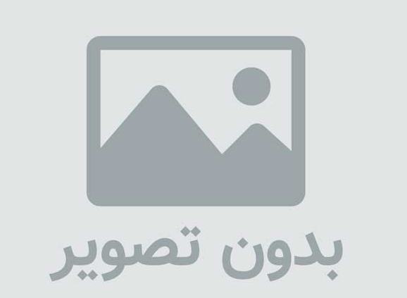 ساخت ایمپلنت دندان